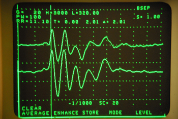 Audiometrie Eviva 350