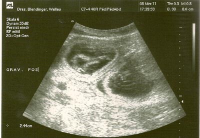 US Queen 32. Tag-400